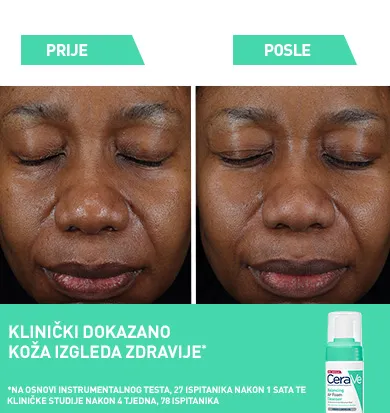 glycolysine-2025-HR-clnically-proven